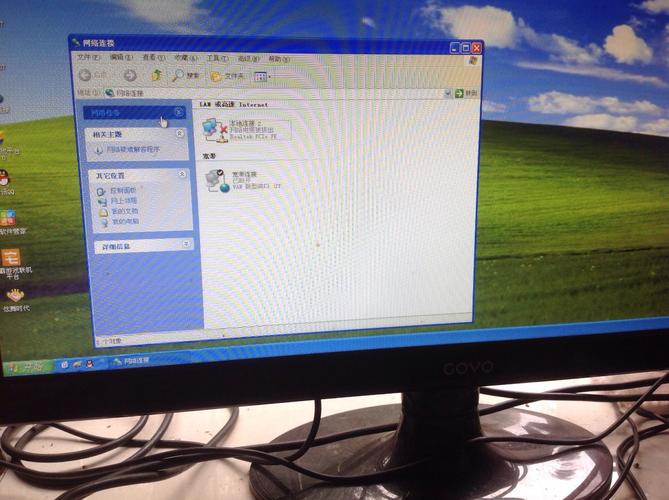 电脑显示网络电缆被拔出